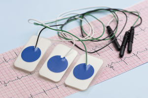 Electrocardiogram - Citrus Cardiology Consultants PA