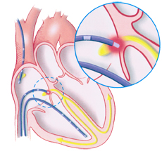 Electrophysiology_Citrus-Cardiology